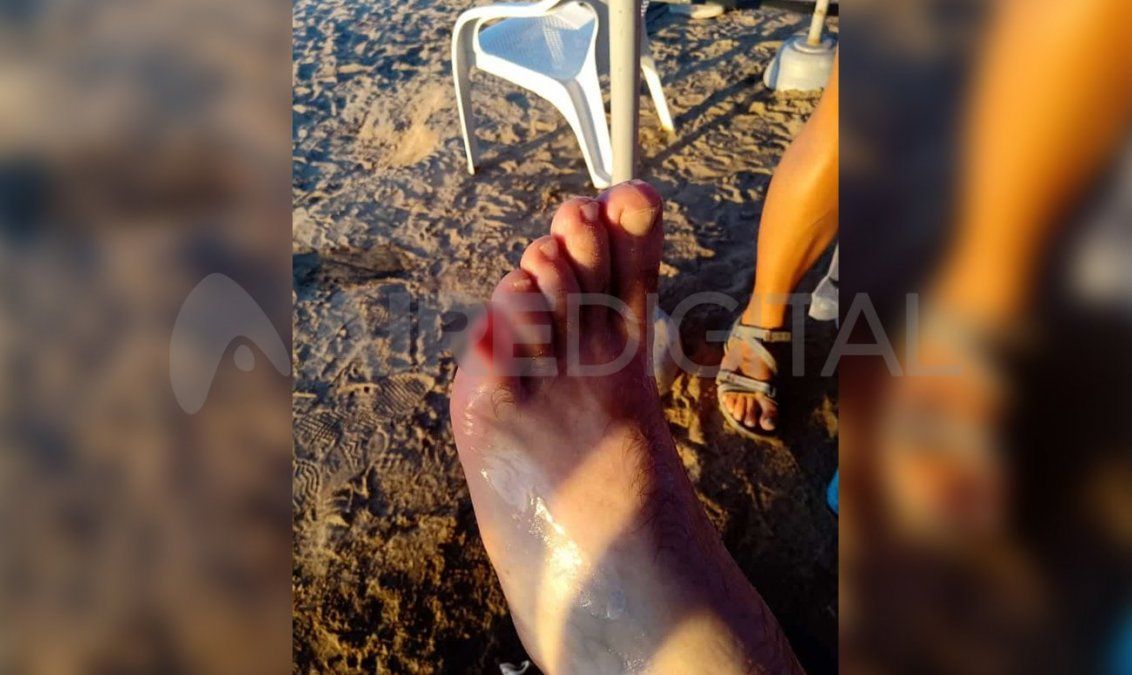 Desde la Municipalidad de Santa Fe lanzaron una serie de recomendaciones para evitar las mordeduras.