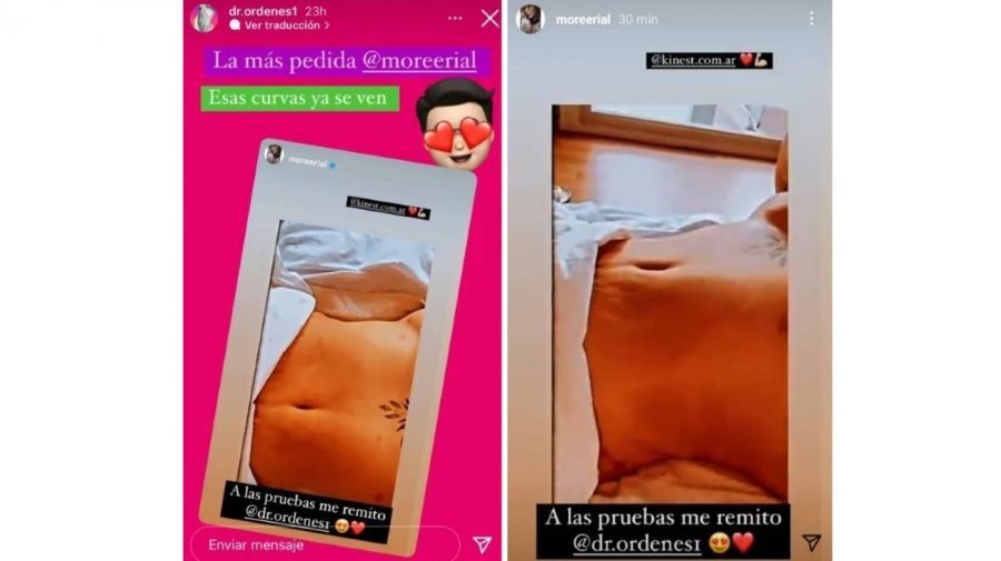 More Rial pasó nuevamente por el quirófano.