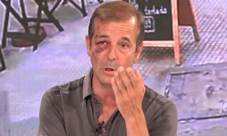 Un periodista de América fue víctima de un robo, resultó herido y tuvo que ser operado Un periodista de América fue víctima de un robo, resultó herido y tuvo que ser operado
