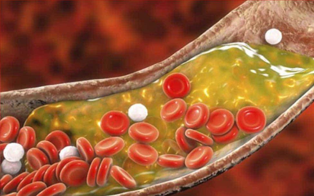 Los mejores alimentos para bajar los triglicéridos durante el desayuno
