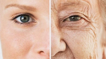 El exceso de azúcar daña el colágeno y la elastina, provocando rigidez en los tejidos.