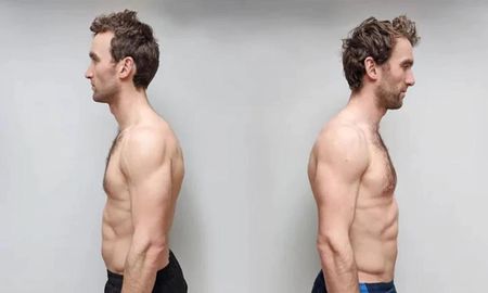Dieta vegana vs dieta carnívora: el experimento definitivo de dos gemelos Dieta vegana vs dieta carnívora: el experimento definitivo de dos gemelos