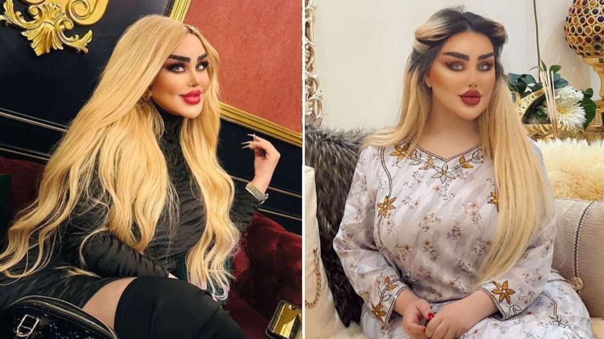 Una mujer se sometió a 43 cirugías para parecerse a Barbie: Dicen que parezco un zombie