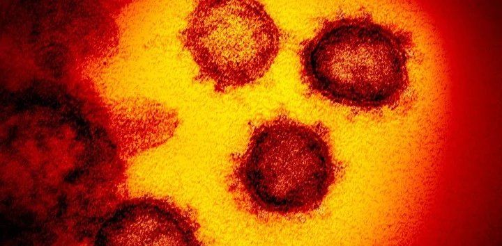 El Covid-19 visto a través de microscopio. Foto: AP