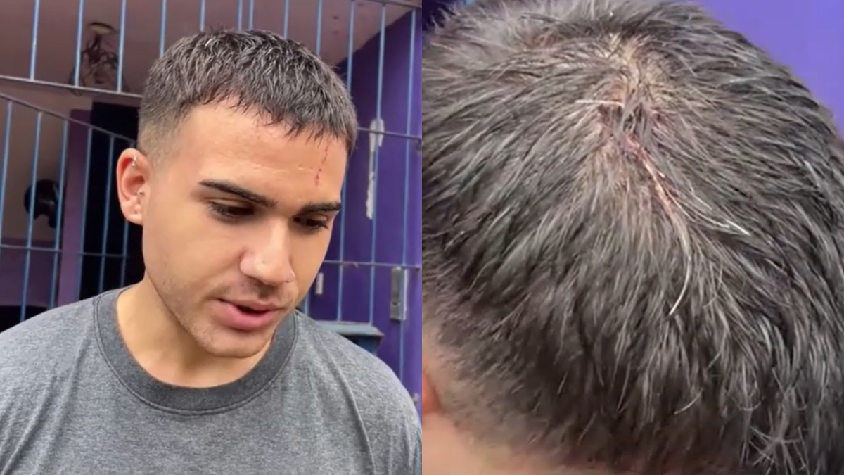 Golpearon con una piedra a joven en Santo Tomé