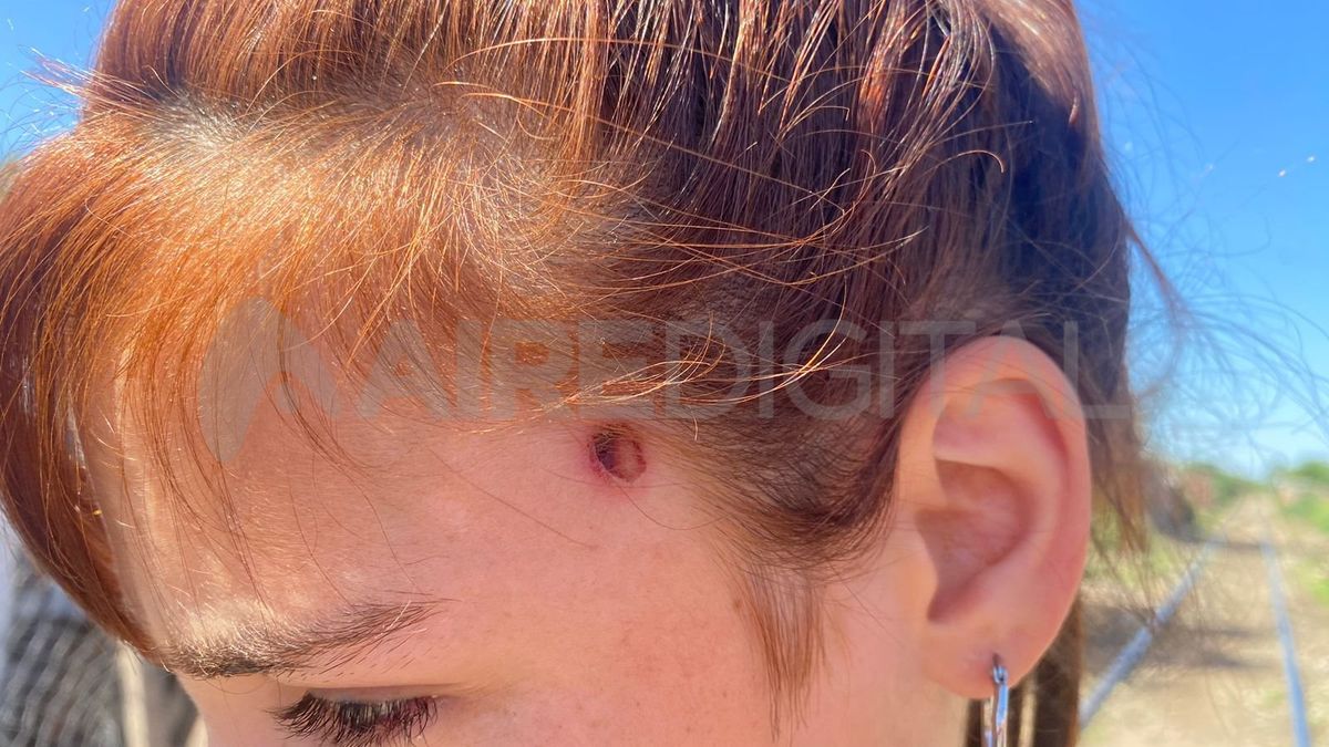 Una nena herida de un balazo de goma en Santa Fe