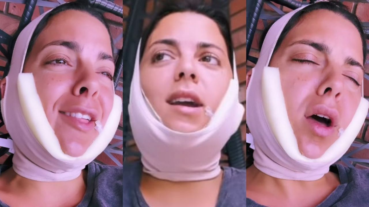 Belu Lucius se hizo un retoque estético y sorprendió a todos.