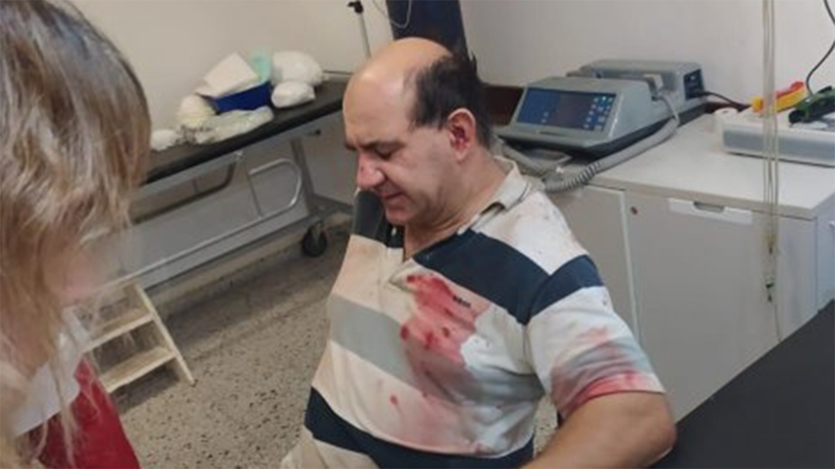 Marcelo&nbsp;Cerutti recibi&oacute; una injusta golpiza de parte de un camionero y su familia