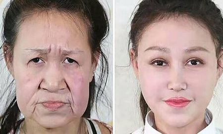 tiene 15 anos pero parecia de 60 y ahora la rejuvenecieron con una cirugia tiene 15 anos pero parecia de 60 y ahora la rejuvenecieron con una cirugia