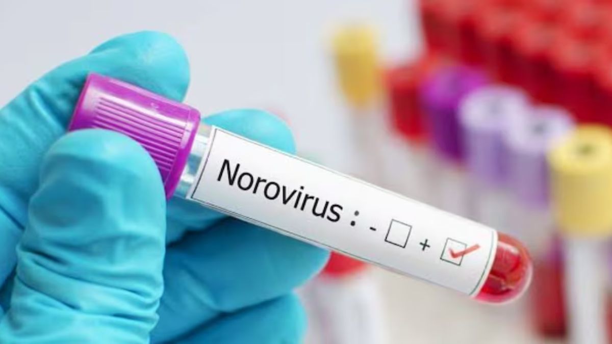 Los protocolos médicos de contingencia exigen el uso exclusivo de agua y jabón para la higiene de manos, dado que los sanitizantes químicos en gel carecen de la efectividad necesaria para neutralizar la estructura del norovirus. Los protocolos médicos de contingencia exigen el uso exclusivo de agua y jabón para la higiene de manos, dado que los sanitizantes químicos en gel carecen de la efectividad necesaria para neutralizar la estructura del norovirus.