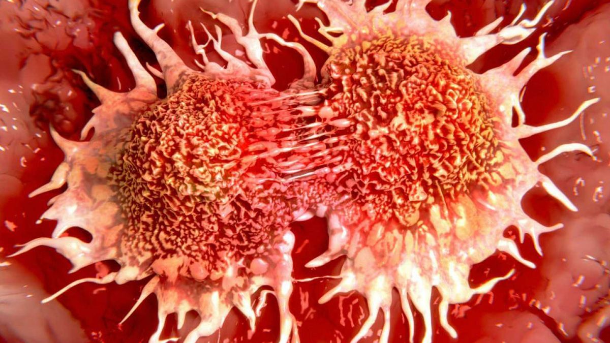 Avance contra el cáncer: científicos descubrieron la causa de la metástasis y estudian un nuevo tratamiento