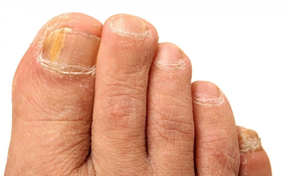 Cuidá tus pies con bicarbonato de sodio