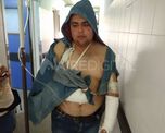 Alexis Lencina es el joven de Coronda accidentado en el vuelco del colectivo en avenida Circunvalaci&oacute;n