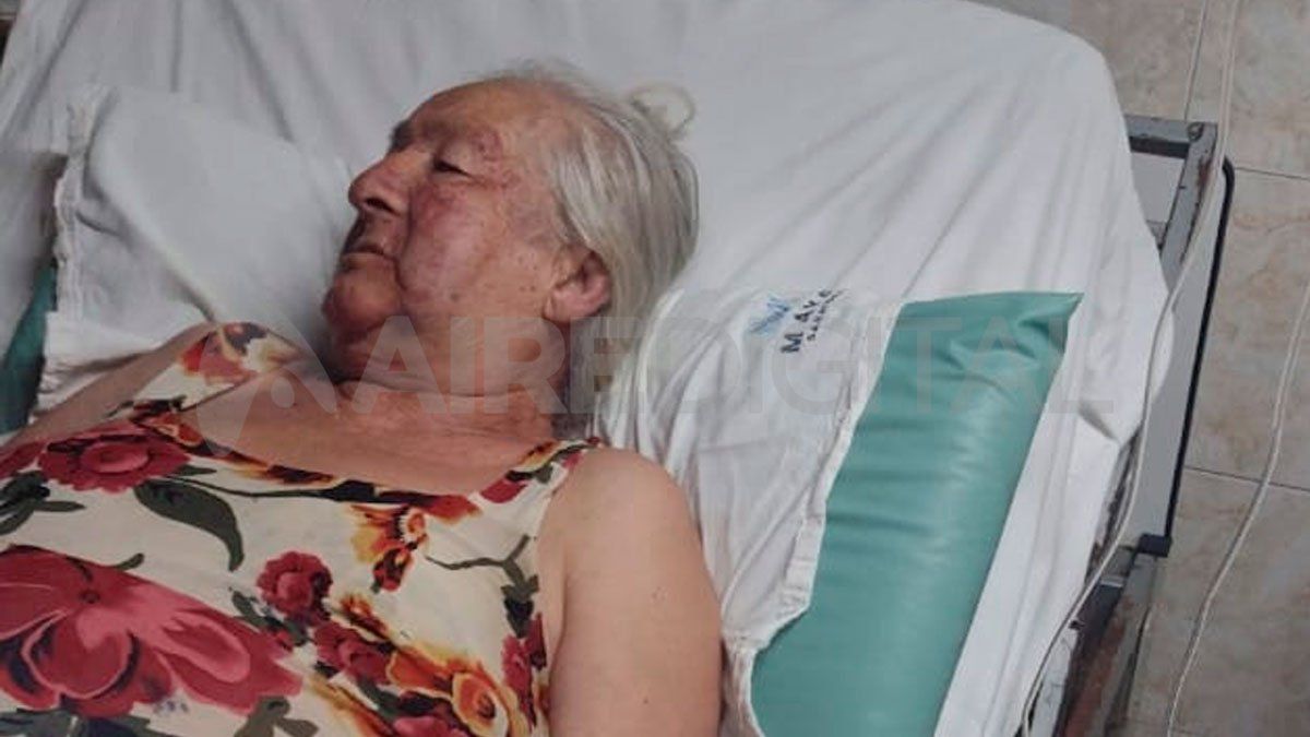 La mujer de 78 años permanece internada en un sanatorio privado y este lunes deberá ser intervenida quirurgicamente.&nbsp;