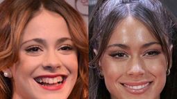 altText(El increíble antes y después de Tini Stoessel: el retoque estético que transformó su cara)}