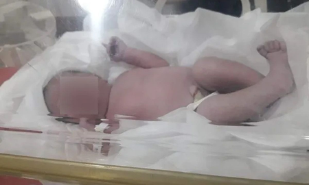 Brutal: abandonaron a un recién nacido que tenía el cordón umbilical Brutal: abandonaron a un recién nacido que tenía el cordón umbilical