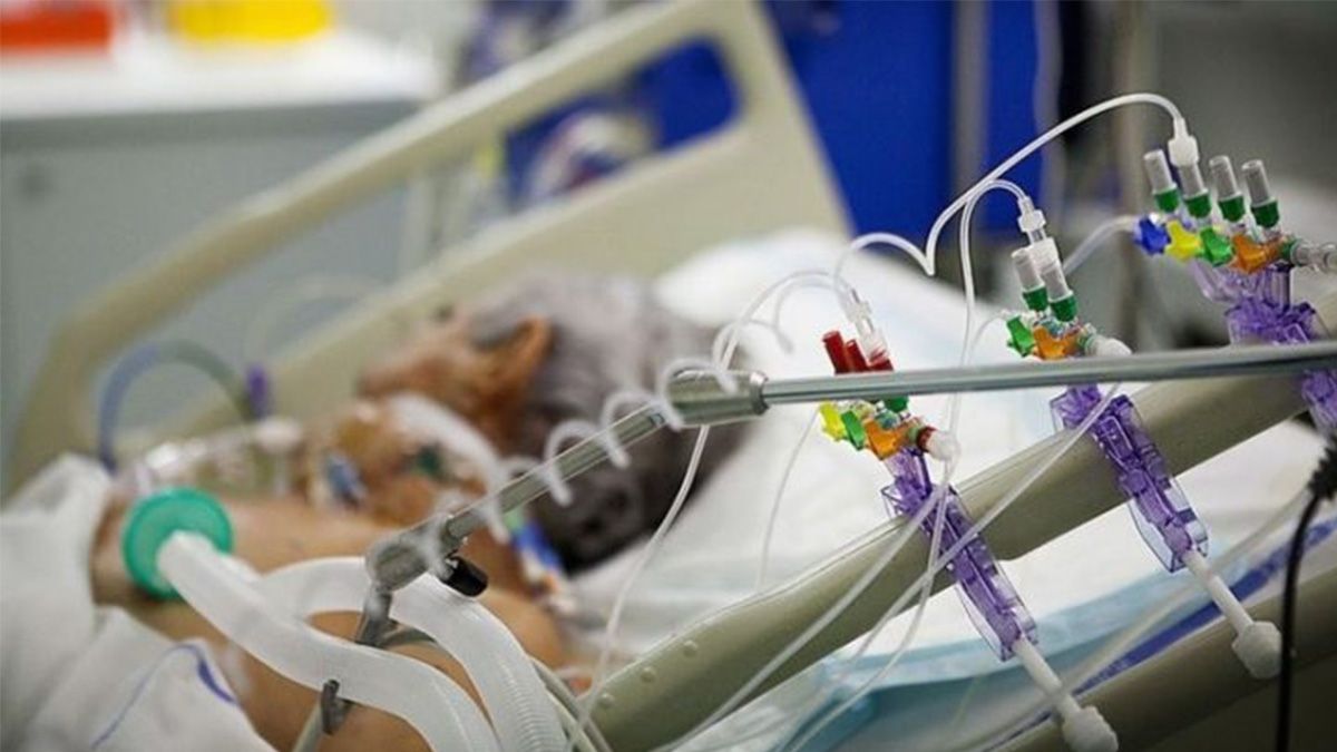 El ministerio de Salud recibió 250 respiradores nuevos sobre un total de 500 unidades