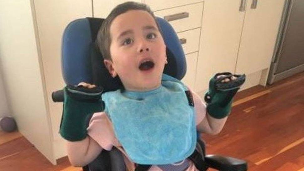 Nene de 2 años se atragantó con una manzana y quedó paralítico