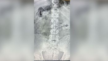 En un operativo sobre la Ruta Nacional 34 a la altura de Ceres, la  Gendarmería Nacional Argentina (GNA) detuvo a dos personas con más de 160 cápsulas de cocaína dentro de su organismo.