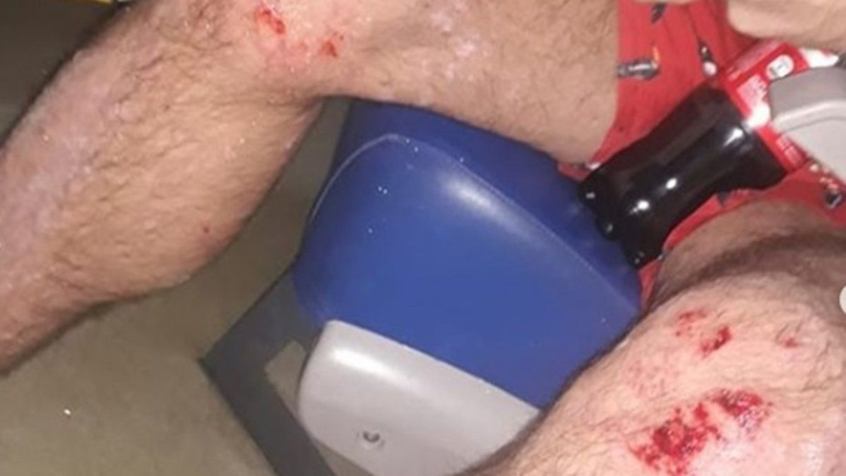 Salvaje ataque homofóbico a una pareja en Villa Urquiza