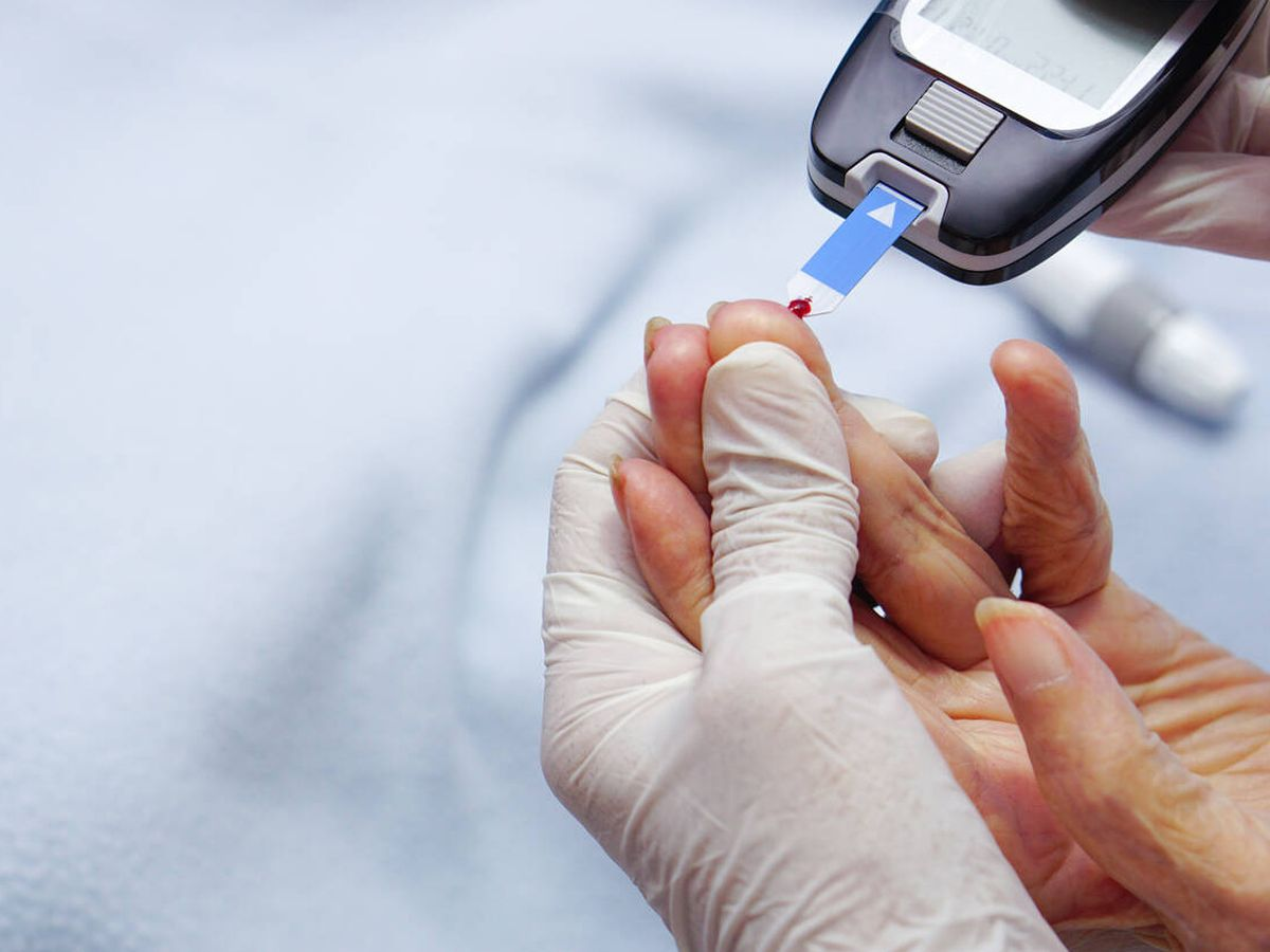 La Diabetes Mellitus (DM) es una enfermedad crónica caracterizada por hiperglucemia. La Diabetes Mellitus (DM) es una enfermedad crónica caracterizada por hiperglucemia.