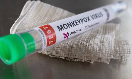 El Ministerio de Salud de Santa Fe brindó datos sobre el primer caso de viruela del mono en la provincia en lo que va del 2024. El Ministerio de Salud de Santa Fe brindó datos sobre el primer caso de viruela del mono en la provincia en lo que va del 2024.