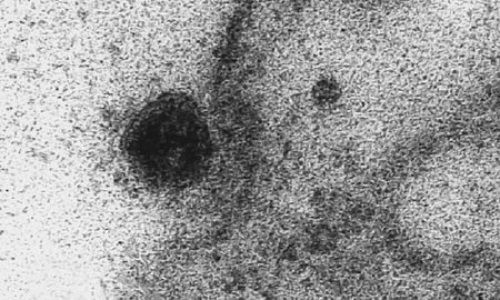 La imagen del microscopio muestra la formación de un punto negro que corresponde al patógeno del COVID-19. (EFE) La imagen del microscopio muestra la formación de un punto negro que corresponde al patógeno del COVID-19. (EFE)