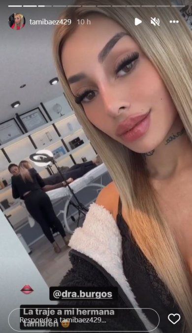 Tamara Báez mostró cómo le quedó su último retoque.