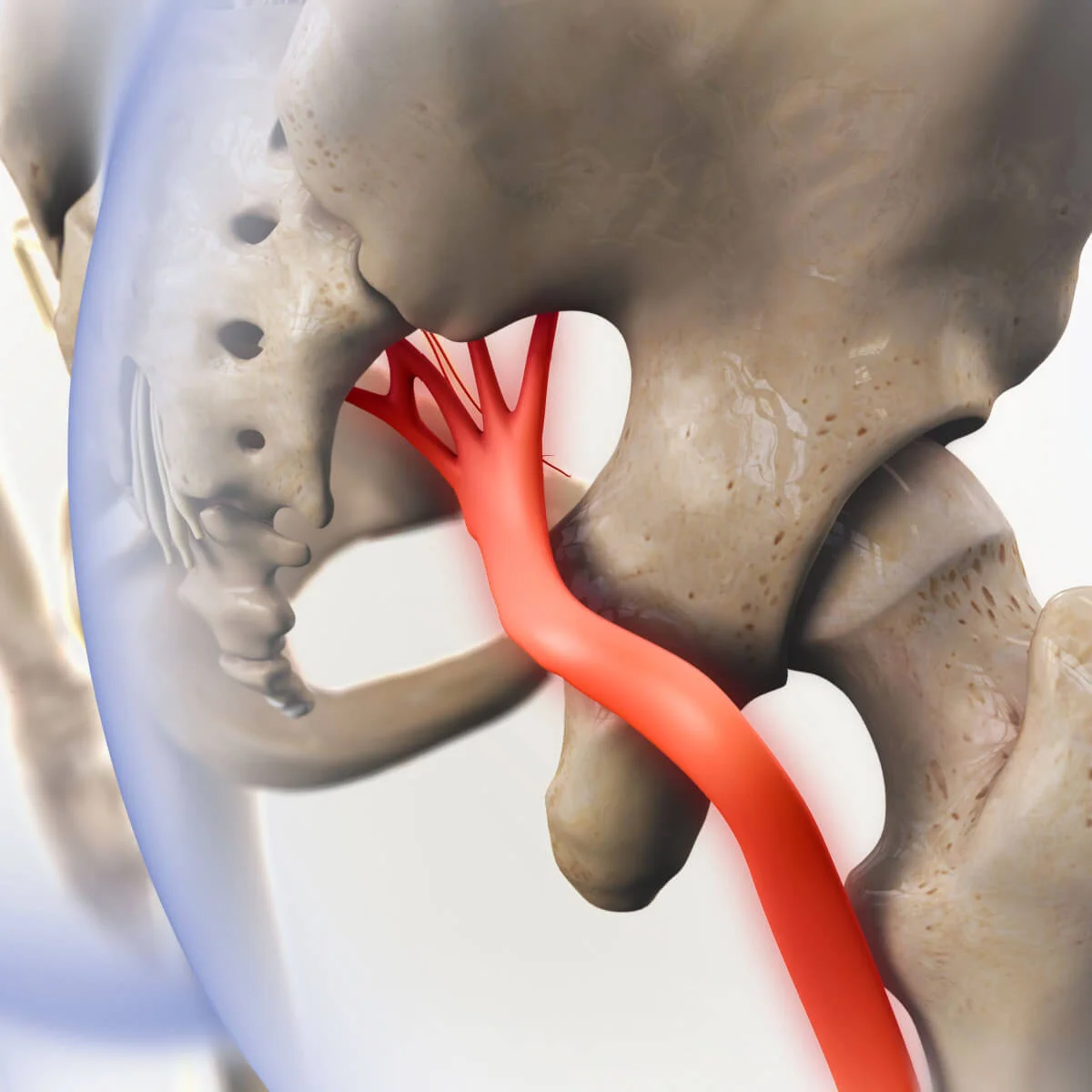El dolor en el nervio ciático puede deberse a múltiples causas. El dolor en el nervio ciático puede deberse a múltiples causas.