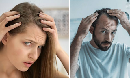 La pérdida de cabello es una de las consultas más frecuentes en dermatología. La pérdida de cabello es una de las consultas más frecuentes en dermatología.