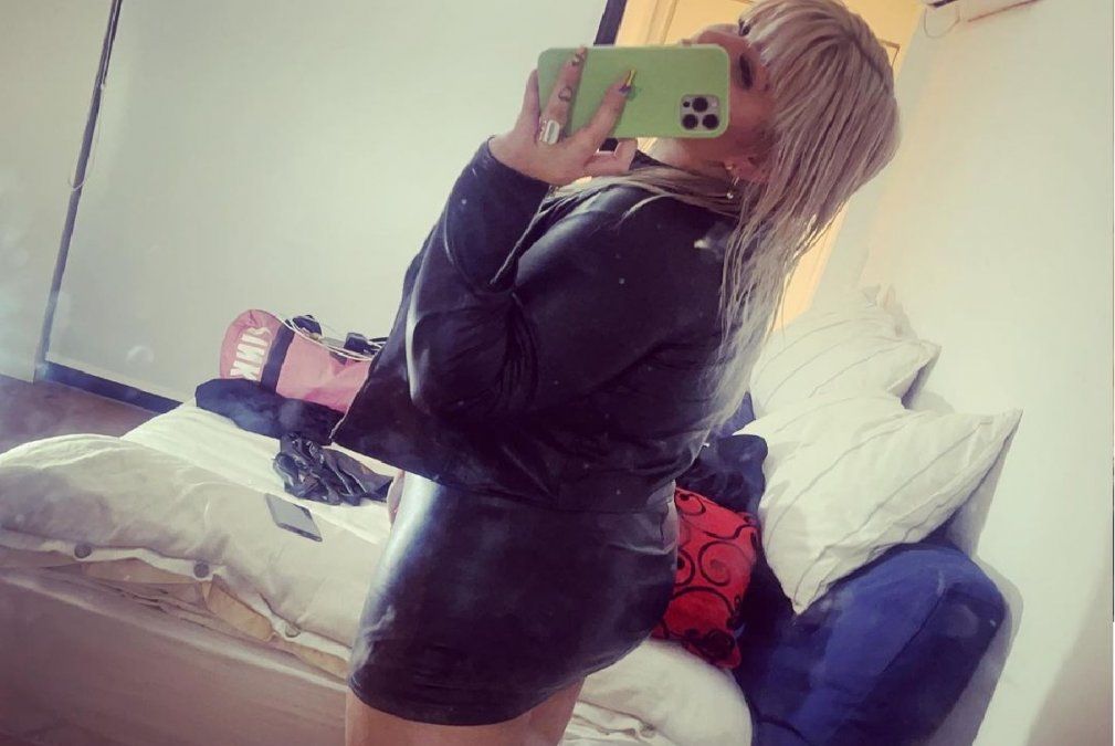 Tras pasar por el quirófano por unos retoques estéticos