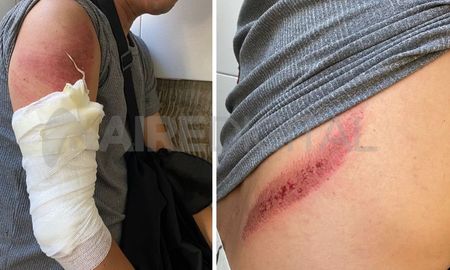 Un motociclista resultó herido en un accidente sobre avenida López y Planes Un motociclista resultó herido en un accidente sobre avenida López y Planes