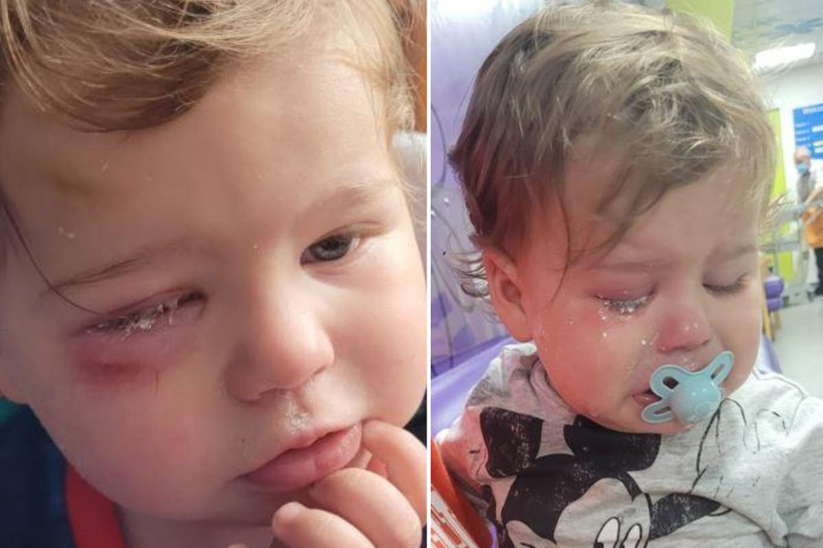 Terror en una guardería de Gran Bretaña: una maestra le tiró pegamento en los ojos a un bebé mientras se arreglaba las uñas