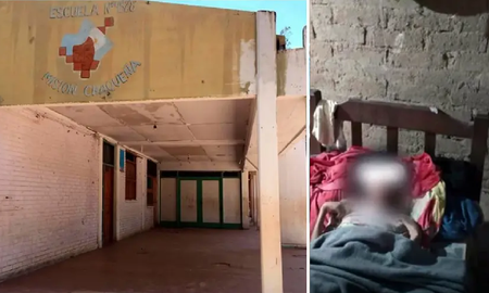 Murió Zaira, la nena wichí de 12 años a quien los chanchos le habían comido los dedos Murió Zaira, la nena wichí de 12 años a quien los chanchos le habían comido los dedos