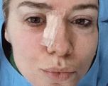 La periodista pidió tomar conciencia sobre la prevención y recomendó realizar controles dermatológicos dos veces por año. La periodista pidió tomar conciencia sobre la prevención y recomendó realizar controles dermatológicos dos veces por año.