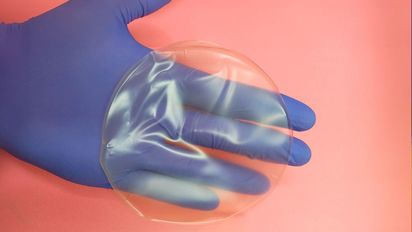 Desarrollan en el Conicet un apósito que acelera la cicatrización y reduce las cicatrices