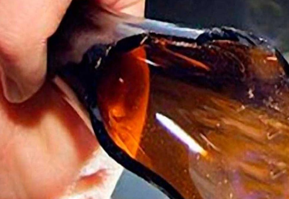 Dio un botellazo en el rostro a su pareja para sacarle dinero