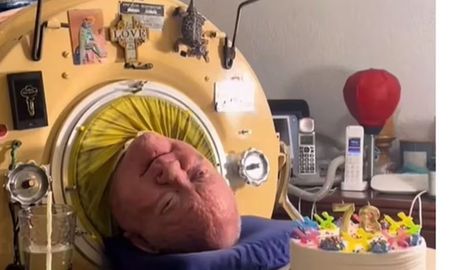 Alexander fue reconocido por el Record Guinnes Mundial por ser la persona que pasó tiempo dentro de un pulmón de metal. Alexander fue reconocido por el Record Guinnes Mundial por ser la persona que pasó tiempo dentro de un pulmón de metal.