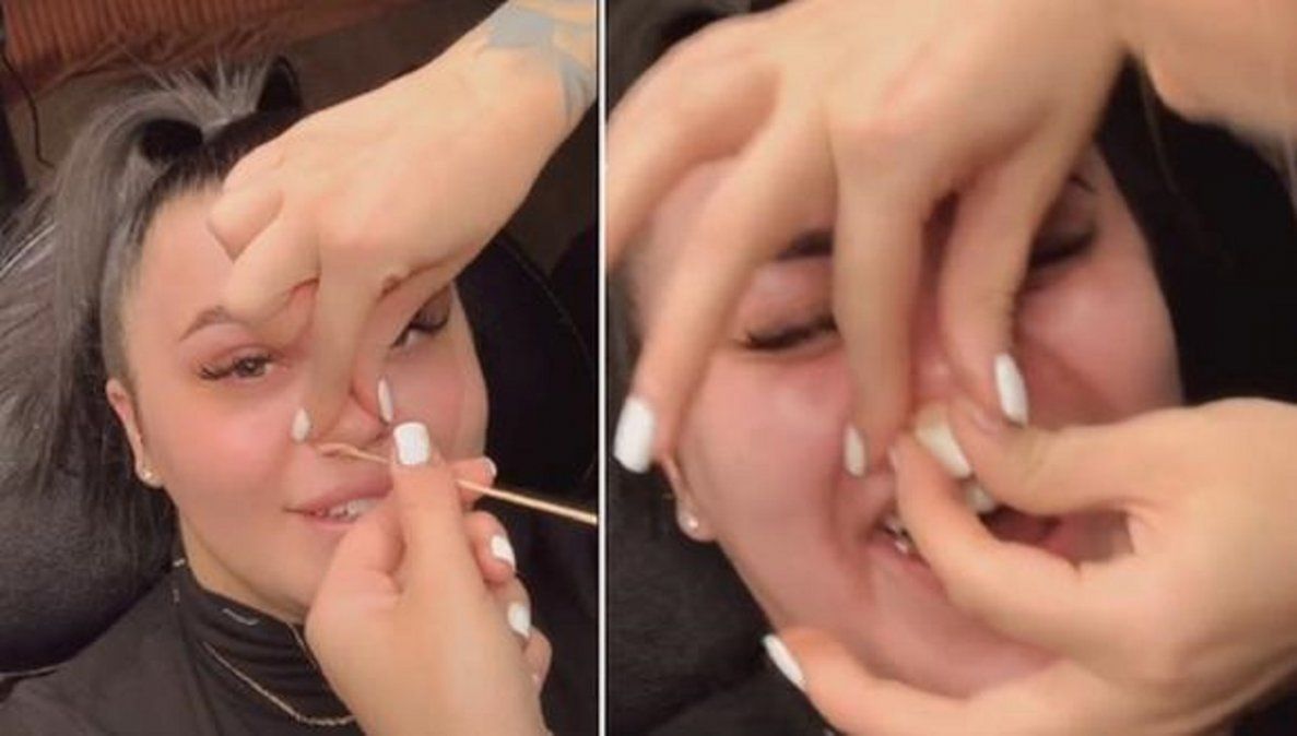Video viral: se quiso sacar el vello de la nariz con cera y sus errores se volvieron furor en TikTok.