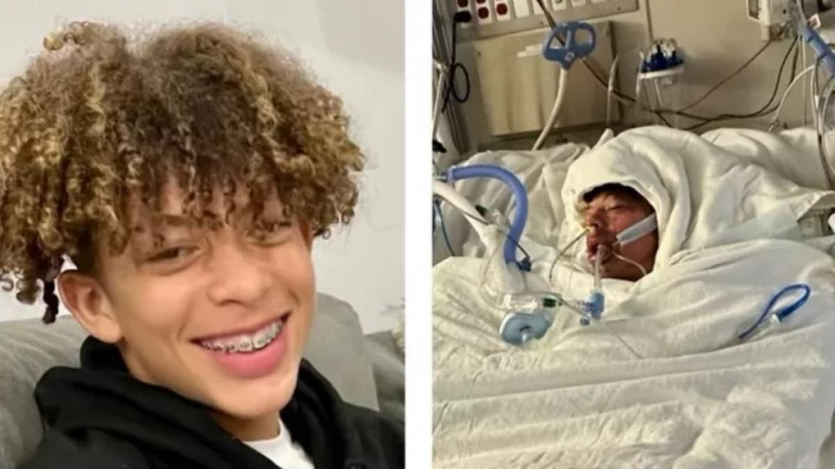 Mason Dark terminó con graves quemaduras luego de intentar un reto viral de TikTok.