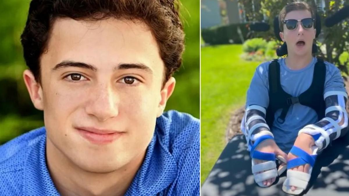 Un estudiante quedó ciego