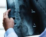 juguetes, crayones, bolas de golf y otros objetos ?olvidados? por pacientes dentro de sus cuerpos juguetes, crayones, bolas de golf y otros objetos ?olvidados? por pacientes dentro de sus cuerpos