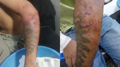 Brutal ataque en Santa Fe: un joven de 19 años fue mordido por varios perros cuando volvía de trabajar