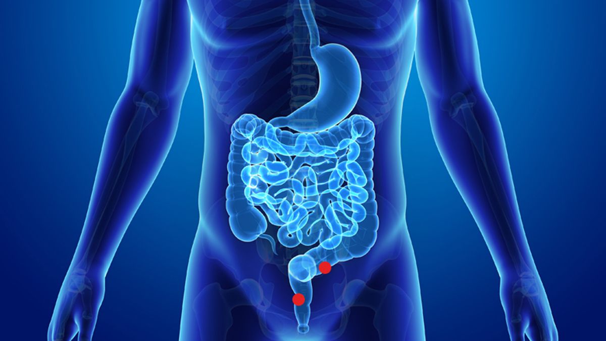 El Ministerio de Salud distribuirá test gratuitos para prevención del cáncer de colon.