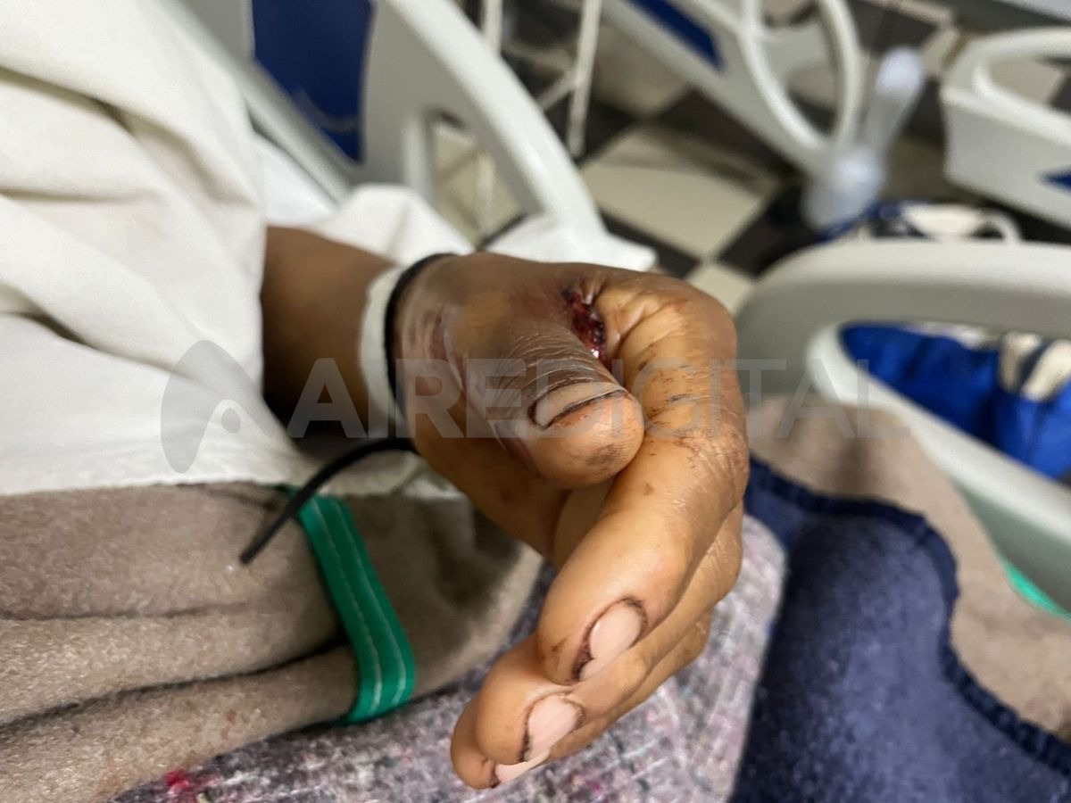 Habló el quintero de Arroyo Leyes apuñalado en ocasión de robo