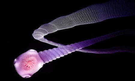 extirparon de la cabeza de un hombre una gran tenia que comio su cerebro durante 15 anos extirparon de la cabeza de un hombre una gran tenia que comio su cerebro durante 15 anos