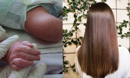 Un producto de alisado para el pelo provocó graves reacciones en un bebé de 6 meses. Un producto de alisado para el pelo provocó graves reacciones en un bebé de 6 meses.
