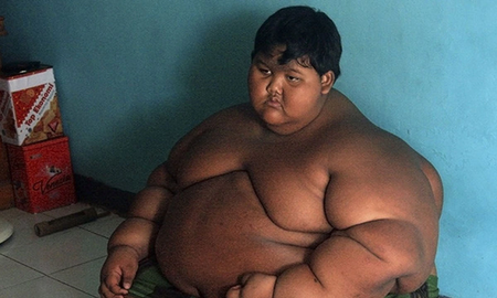 Cómo pudo recuperar su vida el niño más obeso del mundo