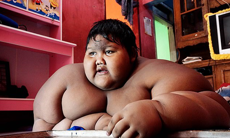 Así está el niño más gordo del mundo luego de bajar 100 kilos