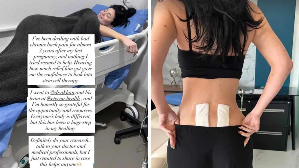 Kylie Jenner preocupó a sus seguidores al mostrarse en una camilla tras un tratamiento con células madre por dolor de espalda. Kylie Jenner preocupó a sus seguidores al mostrarse en una camilla tras un tratamiento con células madre por dolor de espalda.